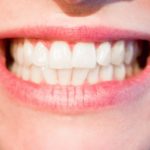 Śliczne zdrowe zęby również wspaniały przepiękny uśmiech to powód do zadowolenia.